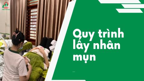 Quy trình lấy nhân mụn