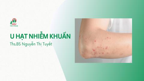 U hạt nhiễm khuẩn