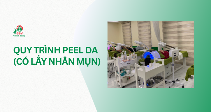 Quy trình Peel da (Có lấy nhân mụn)