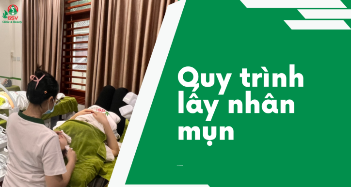 Quy trình lấy nhân mụn