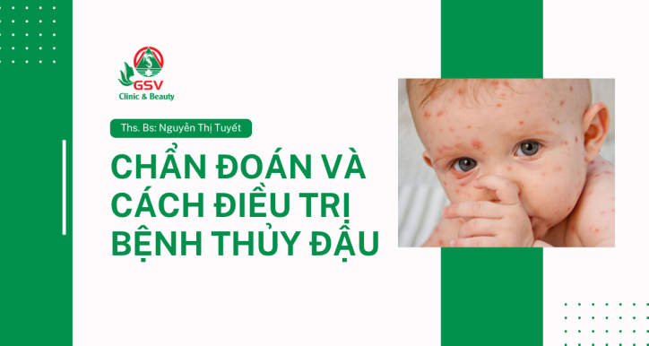 [Bác sĩ] Chẩn đoán và cách điều trị bệnh thủy đậu