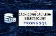 Cách dùng hàm COUNT trong SQL để đếm số lượng bản ghi
